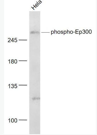 Anti-pphospho-EP300 (Ser1834)  antibody-磷酸化组蛋白乙酰转移酶p300抗体