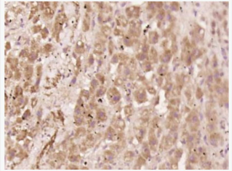 Anti-phospho-NFKB p65 (Ser529) antibody-磷酸化细胞核因子抗体