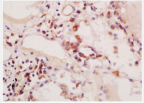 Anti-phospho-PIK3C3 (Ser164)  antibody-磷酸化磷脂酰肌醇激酶3催化亚单位3抗体