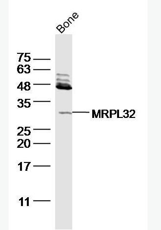 Anti-FGF23  antibody-成纤维细胞生长因子23抗体