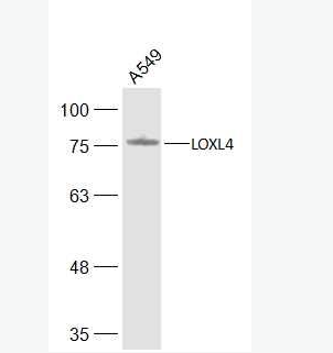 Anti-LOXL4 antibody-赖氨酰氧化酶样蛋白4抗体