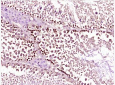 Anti-Cyclin A1  antibody-周期素A1蛋白抗体