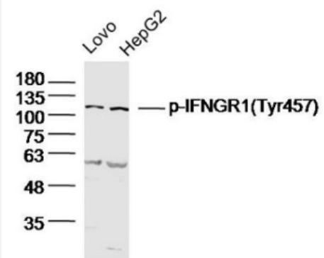 Anti-Phospho-Insulin Receptor (Tyr999)   antibody-磷酸化胰岛素受体抗体