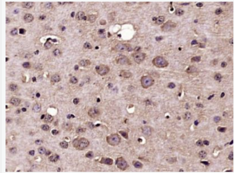 Anti-Nucleoporin p62 antibody-核孔糖蛋白P62抗体