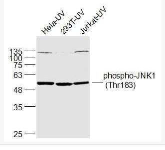 Anti-phospho-JNK1 (Thr183) antibody-磷酸化氨基末端激酶1抗体