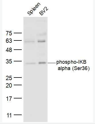 Anti-phphospho-IKB alpha (Ser36)  antibody-磷酸化核因子κB抑制蛋白α抗体体