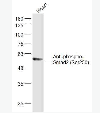 Anti-phospho-Smad2 (Ser250) antibody-磷酸化细胞信号转导分子SMAD2抗体
