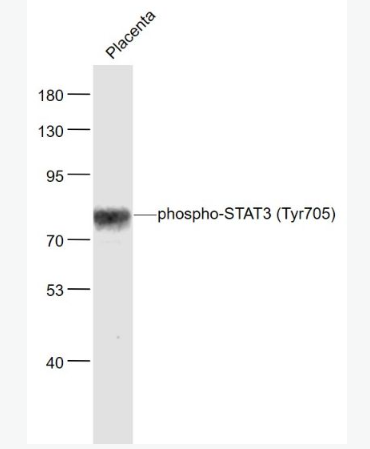 Anti-phospho-STAT3 (Tyr705)antibody-磷酸化信号转导和转录激活因子3抗体
