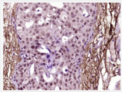 Anti-phospho-JAK2 (Tyr221) antibody-磷酸化蛋白酪氨酸激酶JAK-2抗体