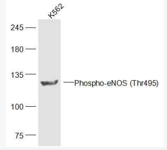 Anti-Phospho-eNOS (Thr495)antibody-磷酸化一氧化氮合成酶3（内皮型）抗体