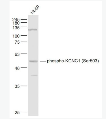 Anti-phospho-KCNC1 (Ser503) antibody-磷酸化离子通道蛋白Kv3.1抗体