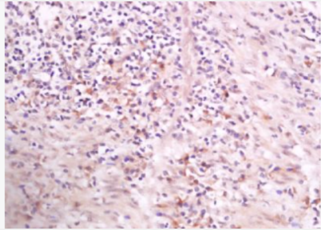 Anti-Phospho-PLCG1 (Tyr783) antibody-磷酸化磷酯酶Cγ1抗体