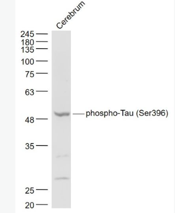 Anti-phospho-Tau (Ser396)  antibody-磷酸化微管相关蛋白抗体