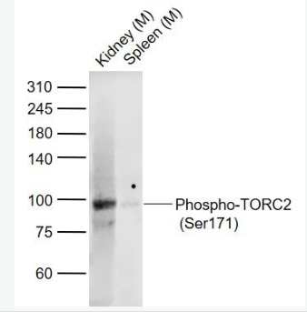 Anti-Phospho-TORC2 (Ser171)  antibody-磷酸化CREB转录共激活因子TORC2抗体