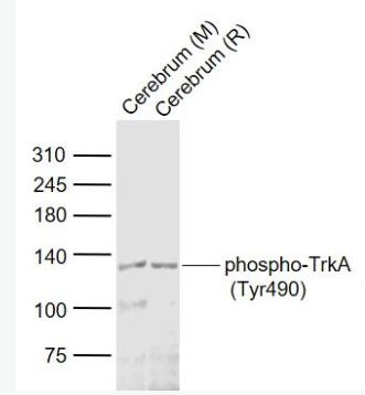 Anti-phospho-TrkA (Tyr490) antibody-磷酸化酪氨酸激酶A抗体