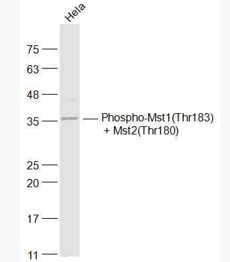 Anti-Phospho-Mst1(Thr183) + Mst2(Thr180) antibody-磷酸化蛋白激酶MST抗体