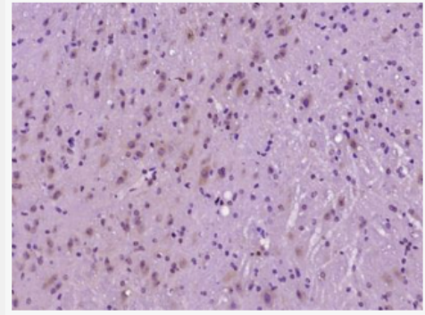 Anti-phospho-AMPK beta 1 (Ser108) antibody-磷酸化腺苷单磷酸活化蛋白激酶β1抗体