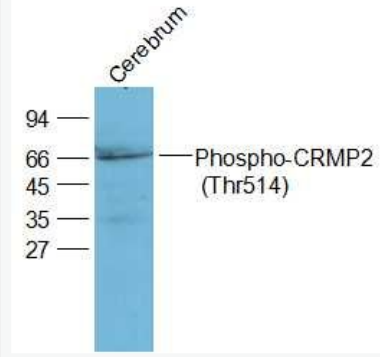 Anti-Phospho-CRMP2 (Thr514) antibody-磷酸化二氢嘧啶酶样2(CRMP2/DPYL2)抗体