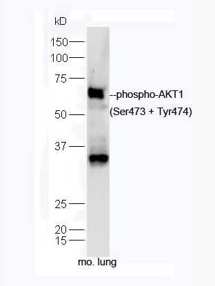 Anti-phospho-AKT1 (Ser473 + Tyr474) antibody-磷酸化蛋白激酶AKT1抗体