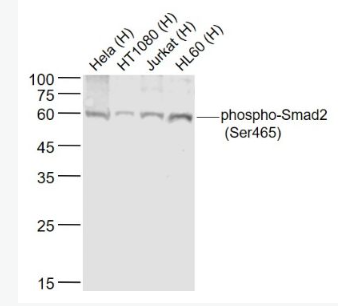 Anti-phospho-Smad2 (Ser465) antibody-磷酸化Smad2抗体