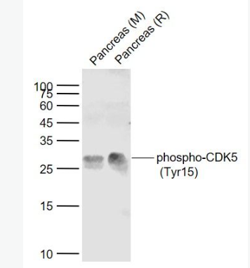 Anti-phospho-CDK5 (Tyr15)  antibody-磷酸化周期素依赖性激酶5抗体