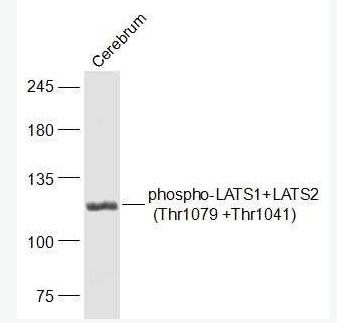 Anti-phospho-LATS1+LATS2 (Thr1079 +Thr1041) antibody-磷酸化肿瘤抑制基因LATS1/LATS2抗体