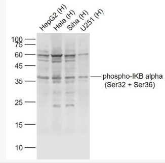 Anti-phospho-IKB alpha (Ser32 + Ser36) antibody-磷酸化p-IκB-α抗体