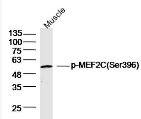 Anti-phospho-MEF2C (Ser396) antibody-磷酸化肌细胞增强因子2C抗体