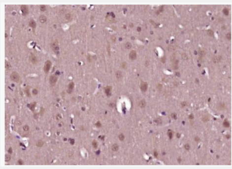 Anti-phospho-Akt (Thr450) antibody-磷酸化蛋白激酶B抗体