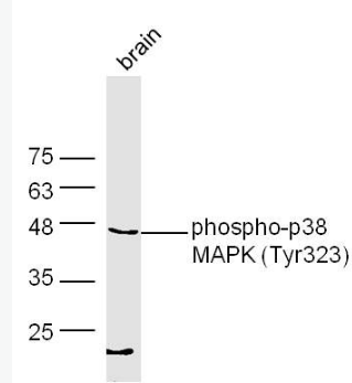 Anti-phospho-p38 MAPK (Tyr323) antibody-磷酸化p38MAPK抗体