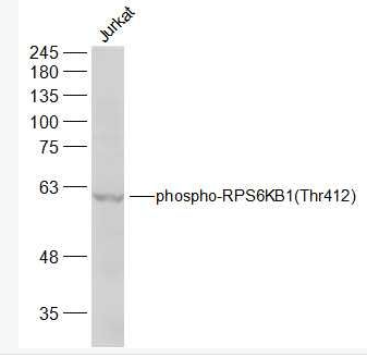 Anti-phospho-RPS6KB1 (Thr412) antibody-磷酸化核糖体S6蛋白激酶抗体