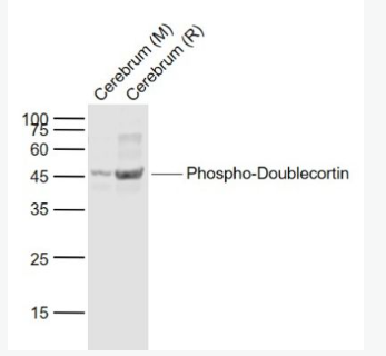 Anti-Phospho-Doublecortin (Ser47) antibody-磷酸化双皮质素抗体