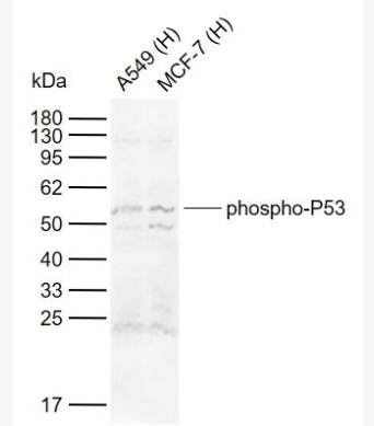 Anti-phospho-P53 (Ser15) antibody-磷酸化肿瘤抑制基因P53抗体