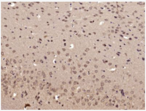 Anti-phospho-RPS6KB1 (Ser417) antibody-磷酸化核糖体S6蛋白激酶抗体