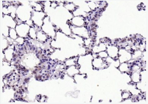 Anti-Phospho-Lyn (Tyr507) antibody-磷酸化膜相关蛋白酪氨酸激酶Lyn抗体