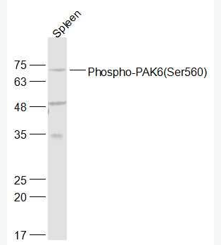 Anti-Phospho-PAK6 (Ser560) antibody-磷酸化p21激活激酶6抗体