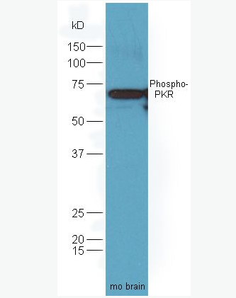 Anti-Phospho-PKR (Thr446) antibody-磷酸化干扰素诱导的双链RNA活化蛋白激酶抗体