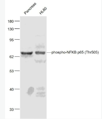 Anti-phospho-NFKB p65 (Thr505) antibody-磷酸化细胞核因子抗体