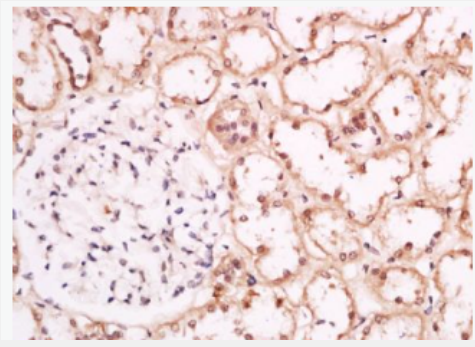 Anti-Phospho-CRTC1 (Ser151) antibody-磷酸化CREB转录共激