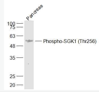 Anti-Phospho-SGK1 (Thr256) antibody-磷酸化糖皮质激素调节激酶1抗体