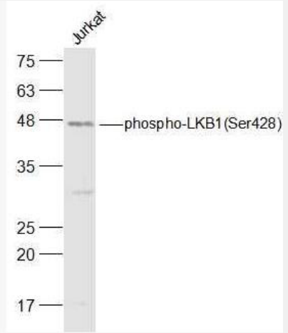 Anti-phospho-LKB1 (Ser428) antibody-磷酸化丝氨酸/苏氨酸蛋白激酶抗体