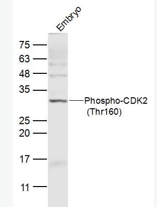 Anti-Phospho-CDK2 (Thr160) antibody-磷酸化周期素依赖性激酶2抗体