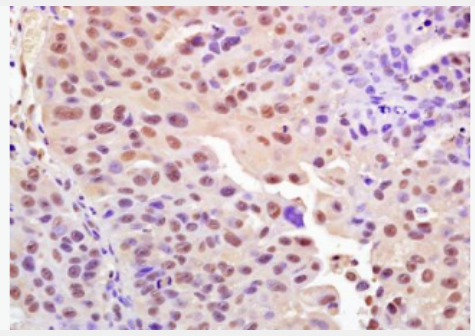 Anti-Phospho-H2AX (Ser139) antibody-磷酸化组蛋白H2AX抗体