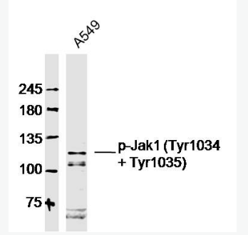 Anti-Phospho-Jak1 (Tyr1034 + Tyr1035) antibody-磷酸化蛋白质酪氨酸激酶JAK-1抗体