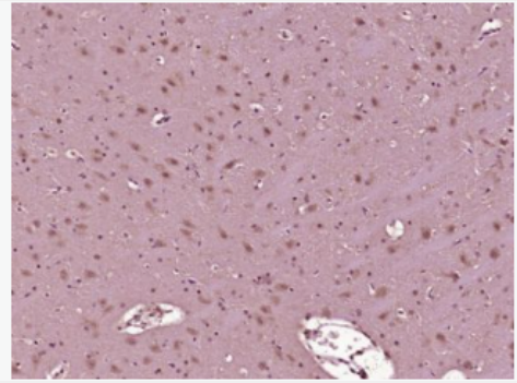 Anti-phospho-AMPK beta 1 + AMPK beta 2 (Ser182/Ser184) antibody-磷酸化腺苷单磷酸活化蛋白激酶β1抗体