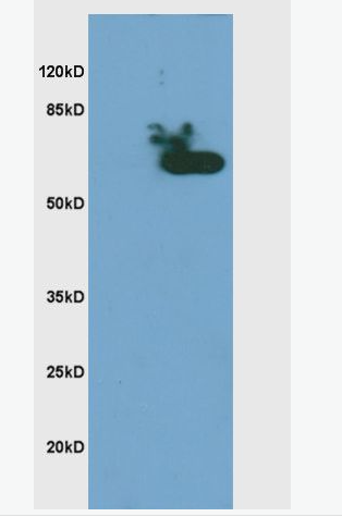 Anti-Phospho-CHEK2 (Thr68) antibody-磷酸化细胞周期检测点激酶2抗体