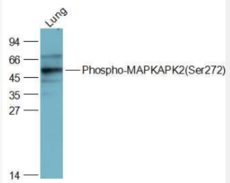 Anti-Phospho-MAPKAPK2 (Ser272) antibody-磷酸化丝裂原活化蛋白激酶活化的蛋白激酶2抗体