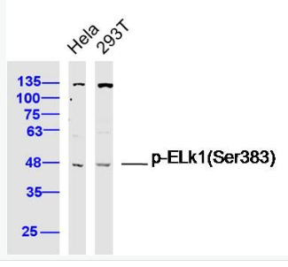Anti-Phospho-ELk1 (Ser383) antibody-磷酸化细胞转录因子ELK1抗体