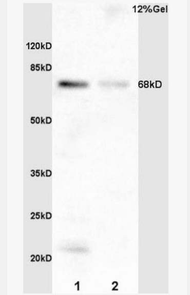 Anti-phospho-TCF3 (Ser39) antibody-磷酸化转录因子3抗体