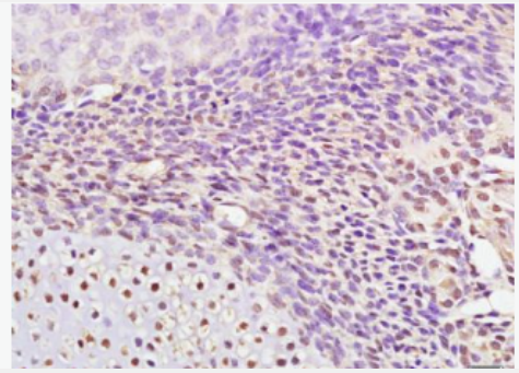 Anti-AP2 gamma antibody-转录因子AP-2γ抗体